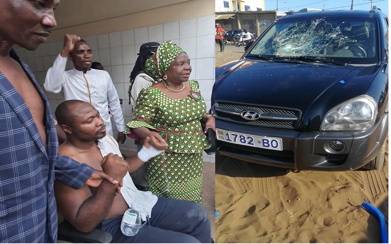 TOGO: le député sénégalais Guy Marius Sagna blessé lors d’une réunion publique